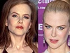 Nicole Kidman ped a po